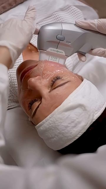 «Провисло» лицо после 35 лет, а к хирургу идти рано? #омоложение #лифтингмосква #подтяжкалица