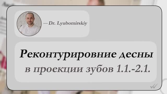 Реконтурирование десны в проекции зубов 1.1 - 2.1 с Геннадием Любомирским
