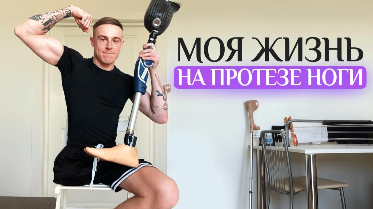 10 лет после ампутации. Как жить с одной ногой?