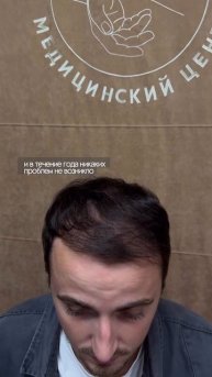 В настоящее время проблему выпадения волос можно решить всего за 1 день.