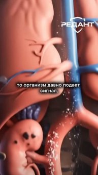 Срочно_посмотрите_какого_цвета_у_вас_моча!