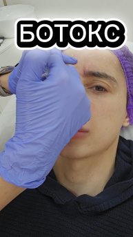 #ботокс #уколыкрасоты #филлеры #филлер #скулы #губы #косметология #косметолог #мужскаякрасота #уход