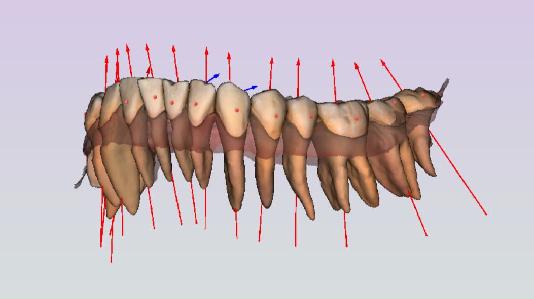 Импорт корней из КТ в Maestro 3D.