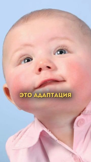 Атопический дерматит