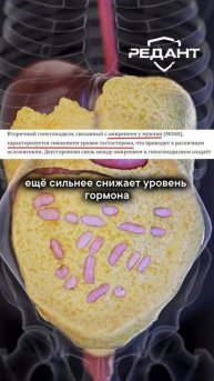 Как_низкий_тестостерон_разрушает_ваше_тело