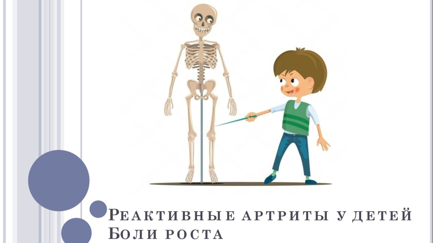 Реактивные артриты у детей. Боли роста.