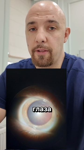 Закрытоугольная глаукома: один приступ уже был — как мы предотвратили второй