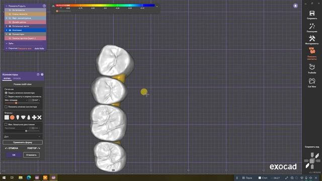 Частично-съемный на жевалки