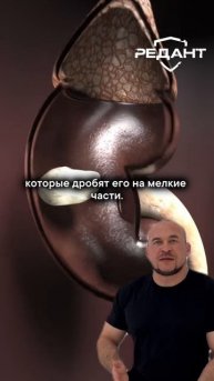 Как выходят камни из почек