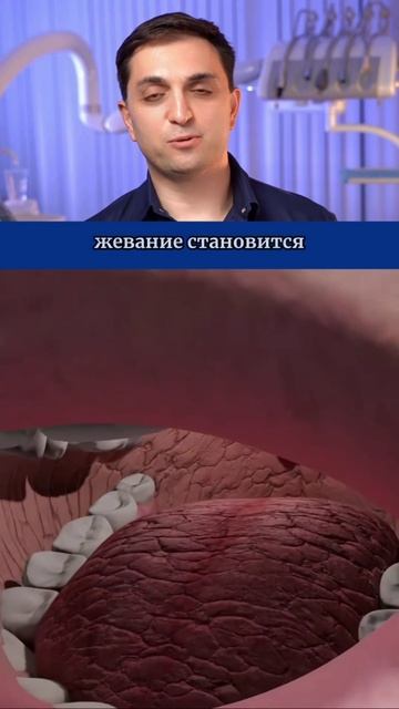 Что будет, если слюна перестанет работать?