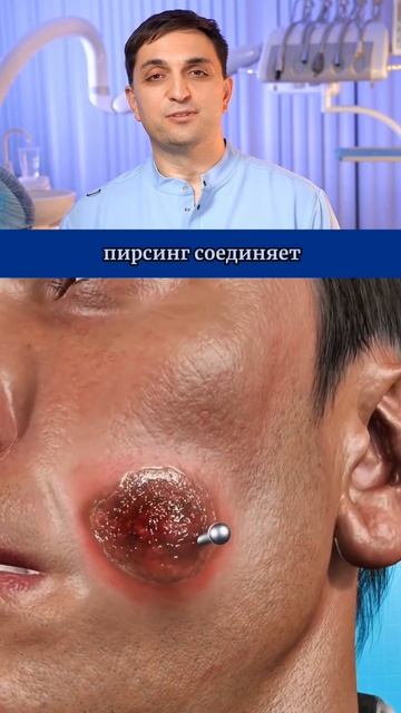 Опасность пирсинга щек