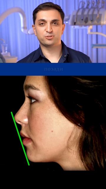 Баланс лица