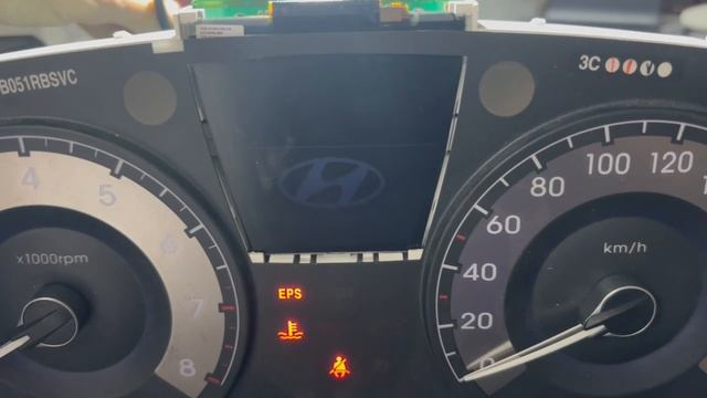 Сток включение Supervision