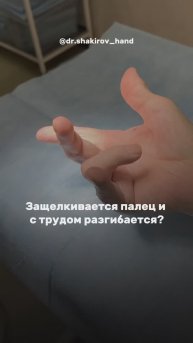 Щелкающий палец