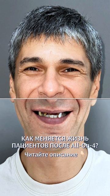 Кейс до и после