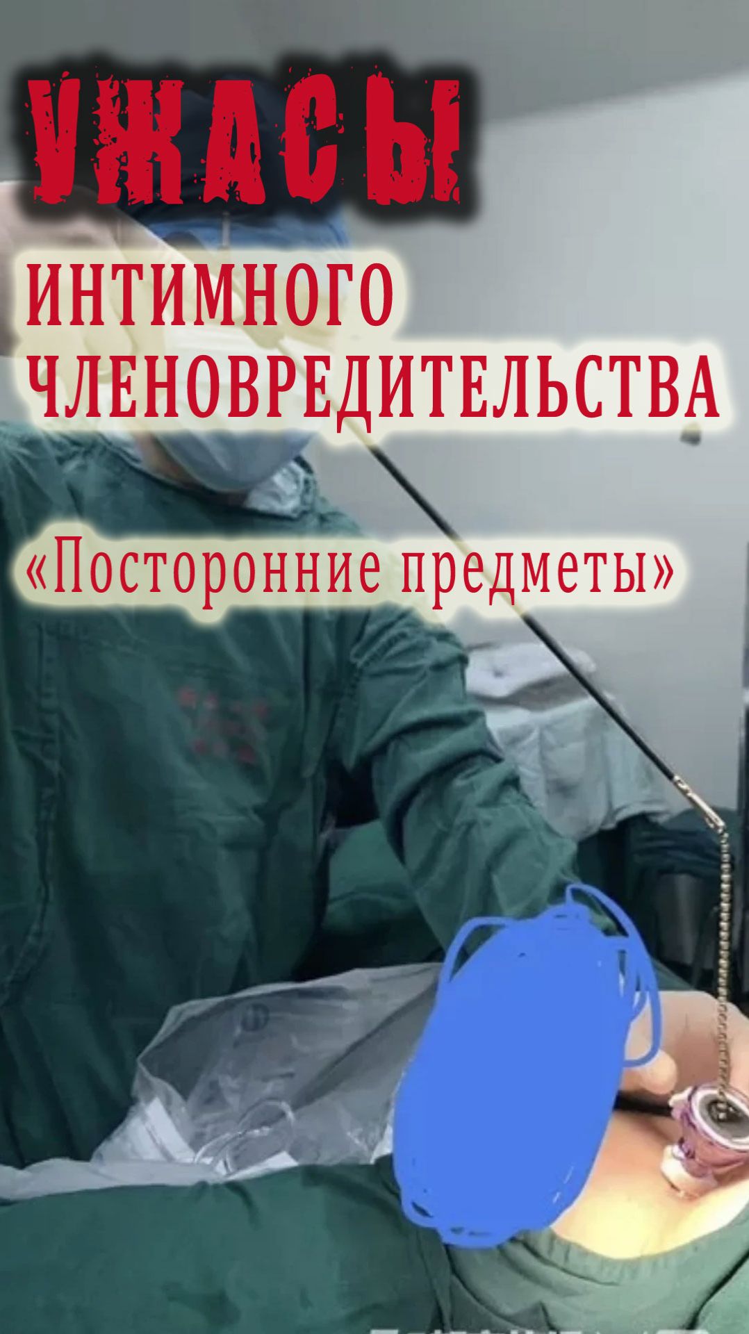 Чем опасны гайки в качестве эрекционных колец