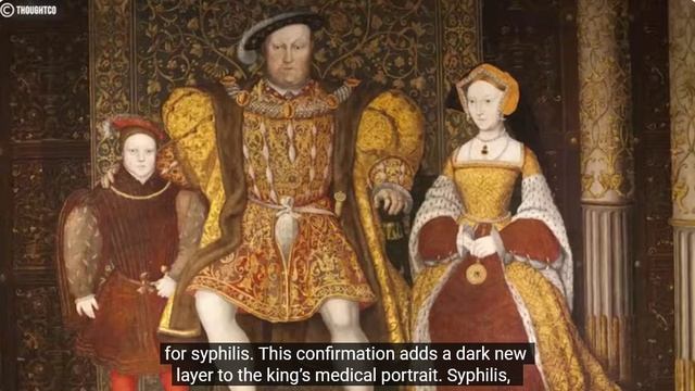 DNA evidence finds the truth about king Henry VIII"s death