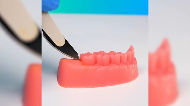 Как это делают хирурги: подборка операций