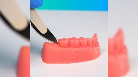 Как это делают хирурги: подборка операций