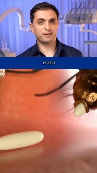 При просмотре ролика вам станет неприятно!