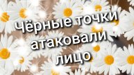 Чёрные точки / атаковали лицо / 7