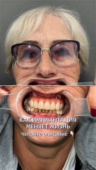 Кейс пациента