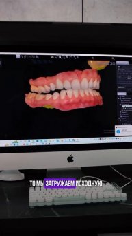 ПЕРВИЧНАЯ КОНСУЛЬТАЦИЯ. Что Вас ждёт на приёме?