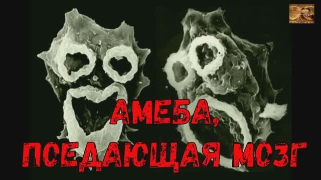 Амёба-мозгоед невидимый убийца вашего мозга