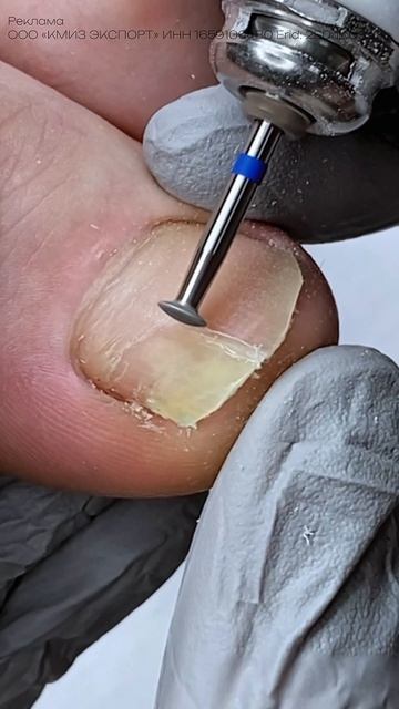 обработка онихолизиса 💪🏼 полное видео у меня в профиле ❤️