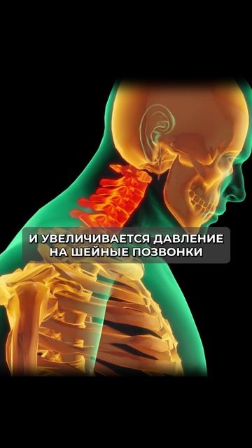 Так вы убиваете свою шею! Как убрать искривление шеи? #больвшее