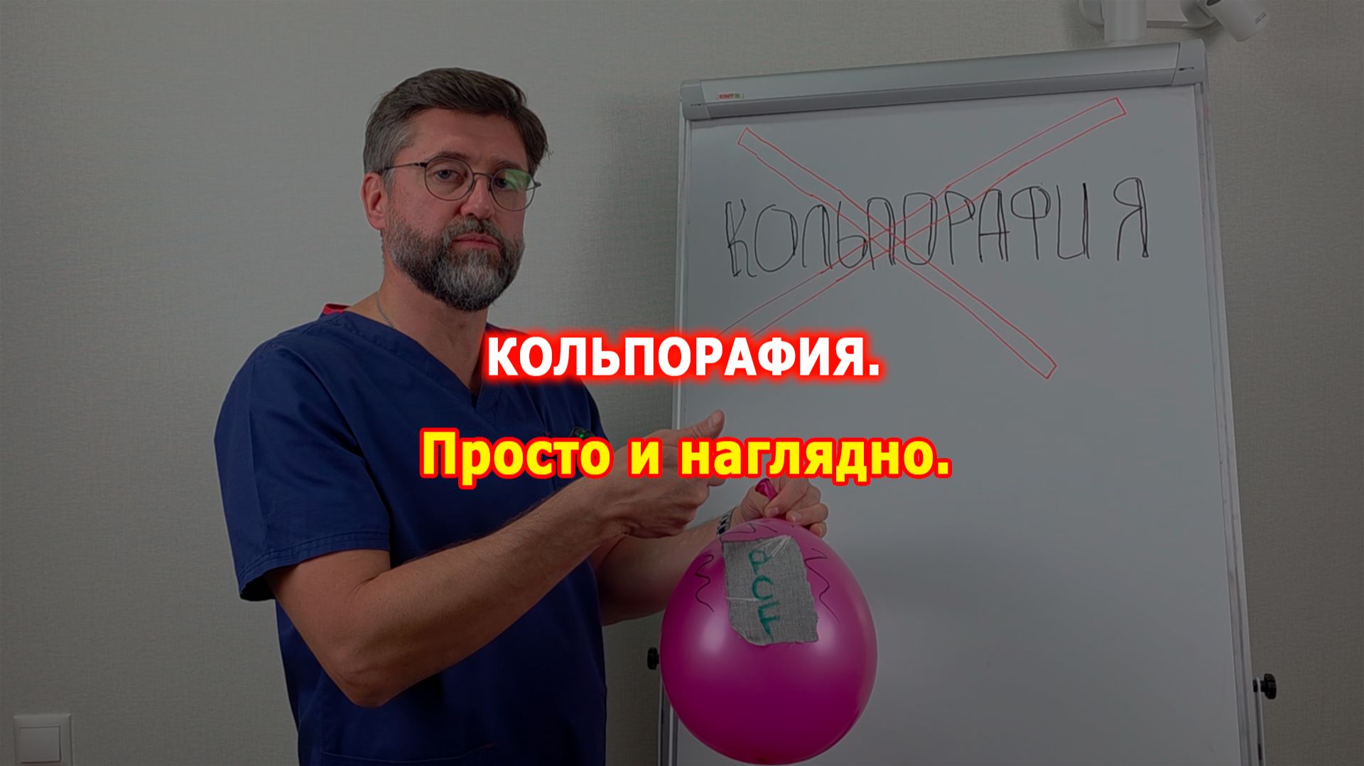 Опущение матки. Операция без "сетки".