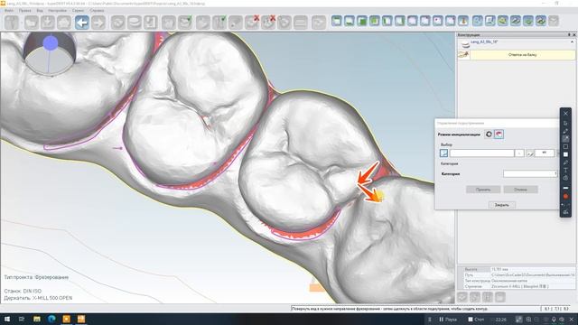 Ответка на балку HyperDent