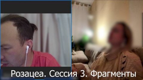 Исцеление Розацеа. Сессия 3. Фрагменты.