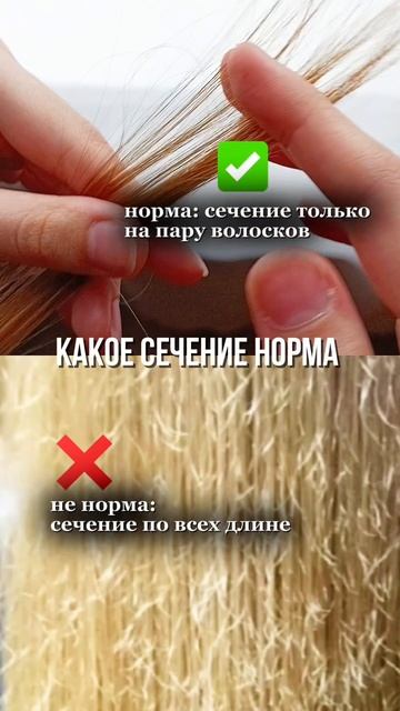 какое сечение норма
