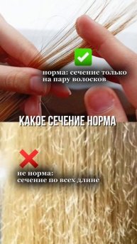 какое сечение норма