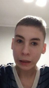 Гнигочтение