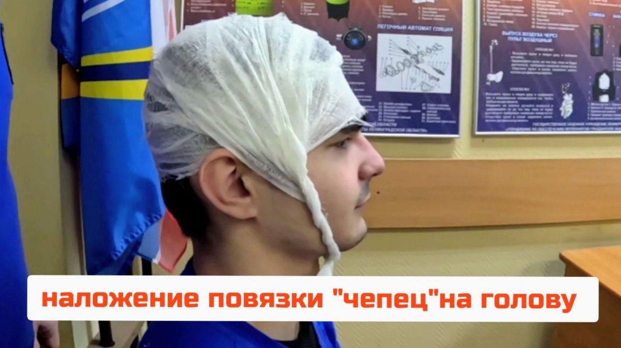 Наложение повязки "чепец"на голову