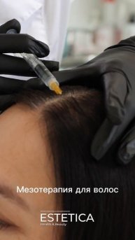Мезотерапия для волос