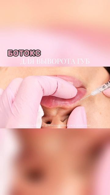 Ботокс для выворота губ