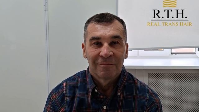 Год после пересадки волос: Валерий Николаевич снова у доктора Двинских!