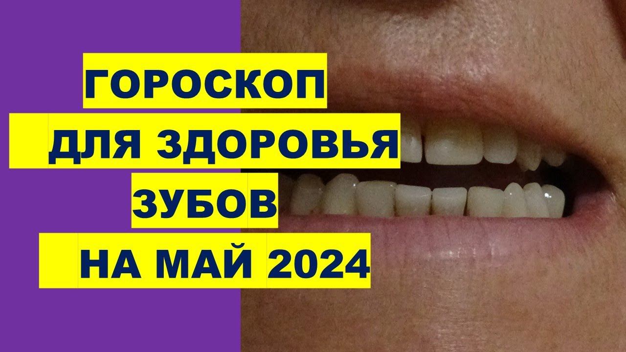 Гороскоп для здоровья зубов на май 2024 года Horoscope for dental health for May 2024