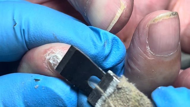Nails that look like fishhooks and havent been trimmed in over 300 daysPedicure Master Lin Jun