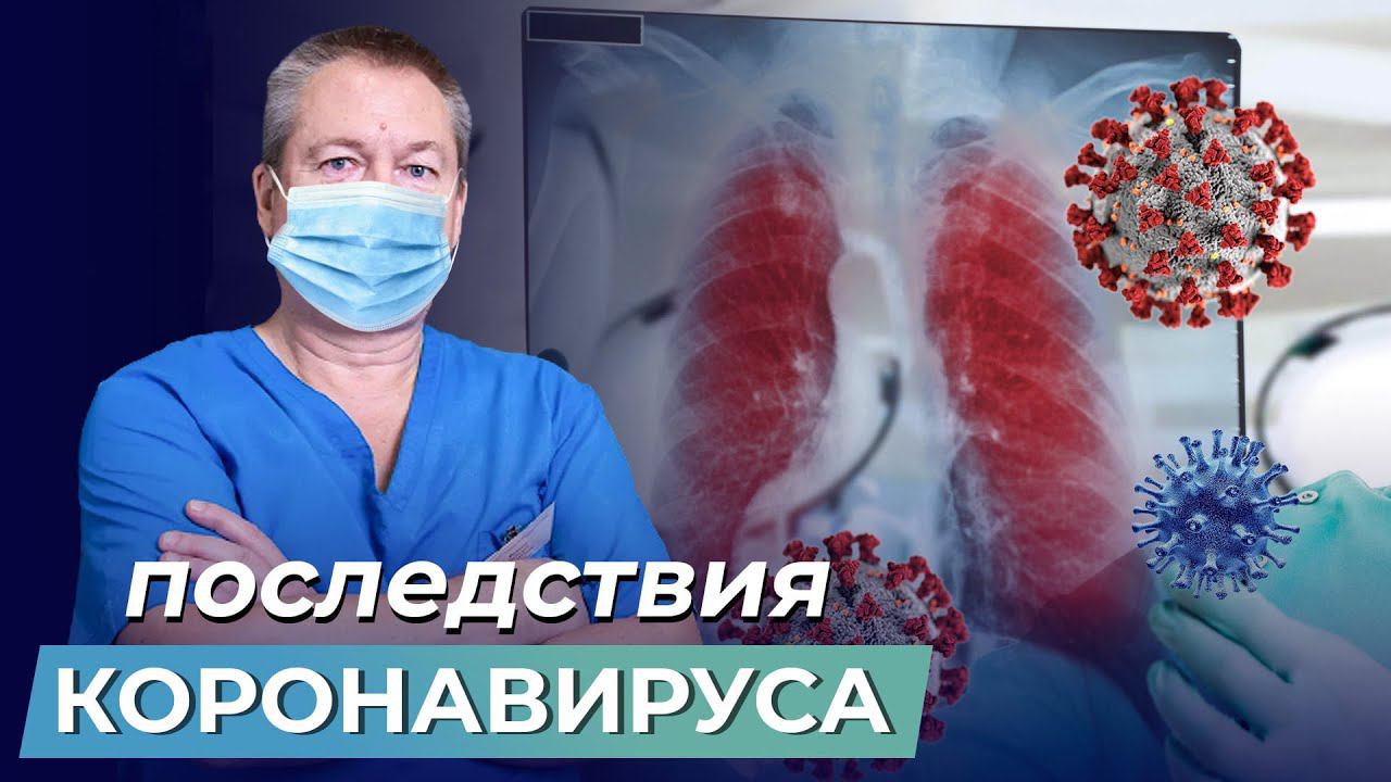 ВЫПАДАЮТ ВОЛОСЫ? Как убрать последствия КОРОНАВИРУСА? Опасности COVID-19, о которых вы не знали