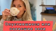 Опустившиеся или нависшие веки. Две минуты в день и глаза откроются. #НаталияСнигирева