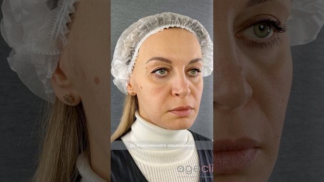 Результат процедуры Fullface
