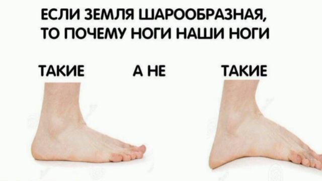 Плоскостопие на земле