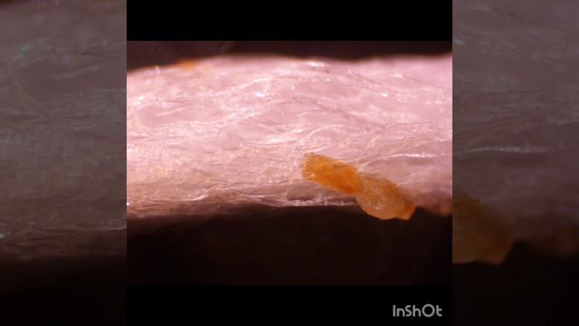 Зубная нить под микроскопом.