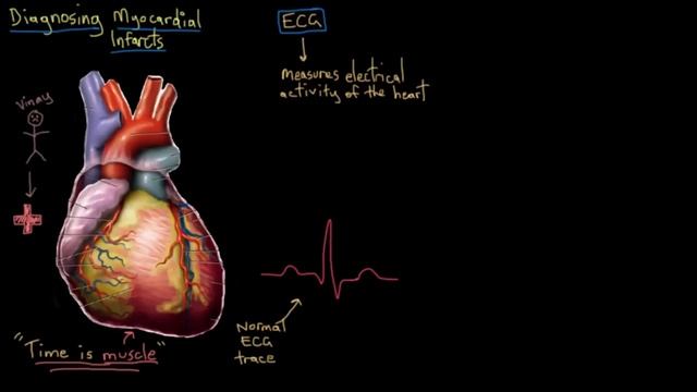 Heart attack (myocardial infarct) diagnosis | NCLEX-RN | Khan Academy