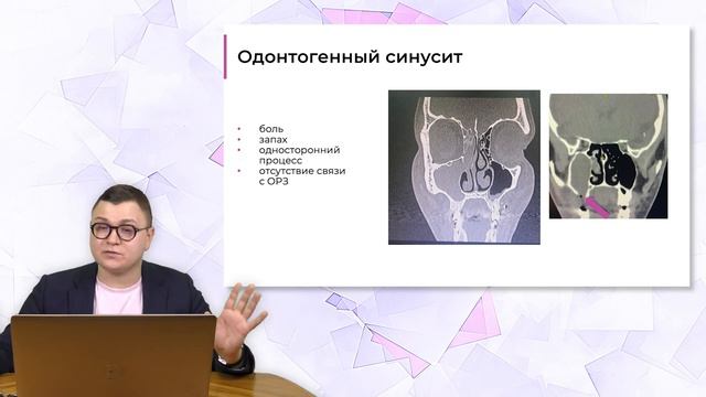 Хронический риносинусит. Дифференциальный диагноз