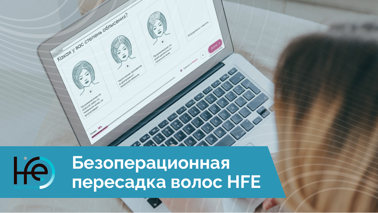 Безоперационная пересадка волос HFE